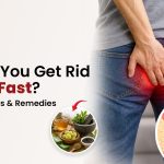 How Do You Get Rid of Piles Fast Quick Relief Tips & Remedies