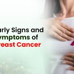 10 Early Signs and Symptoms of Breast Cancer