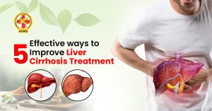 5 Effective ways to Improve Liver Cirrhosis Treatment