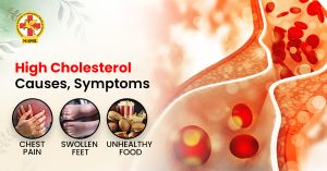High Cholesterol Causes, Symptoms
