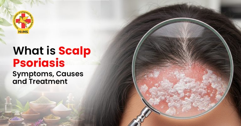 Picture Idea: What Is Scalp Psoriasis Symptoms Causes And Treatment