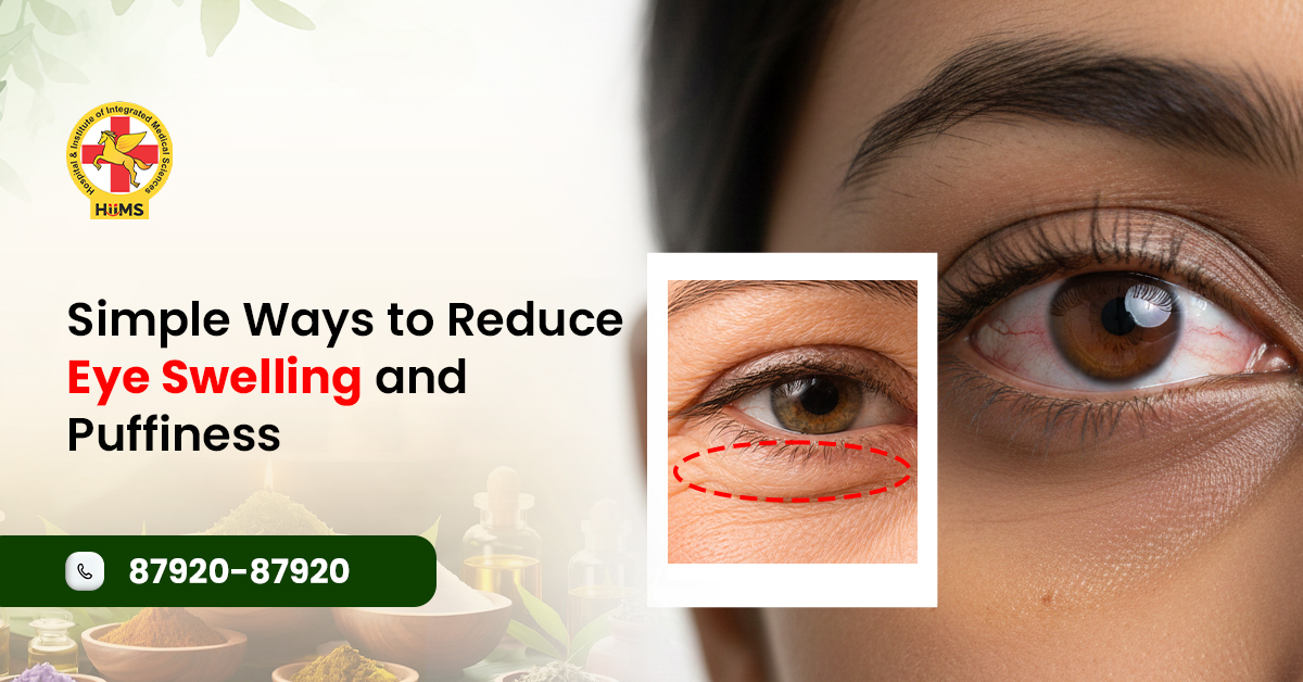 Simple Ways to Reduce Eye Swelling and Puffiness