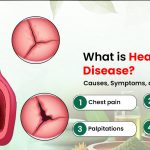 What Is Heart Valve Disease Causes, Symptoms, and Treatment
