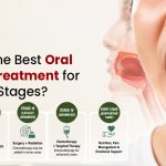 What is the Best Oral Cancer Treatment for Different Stages?