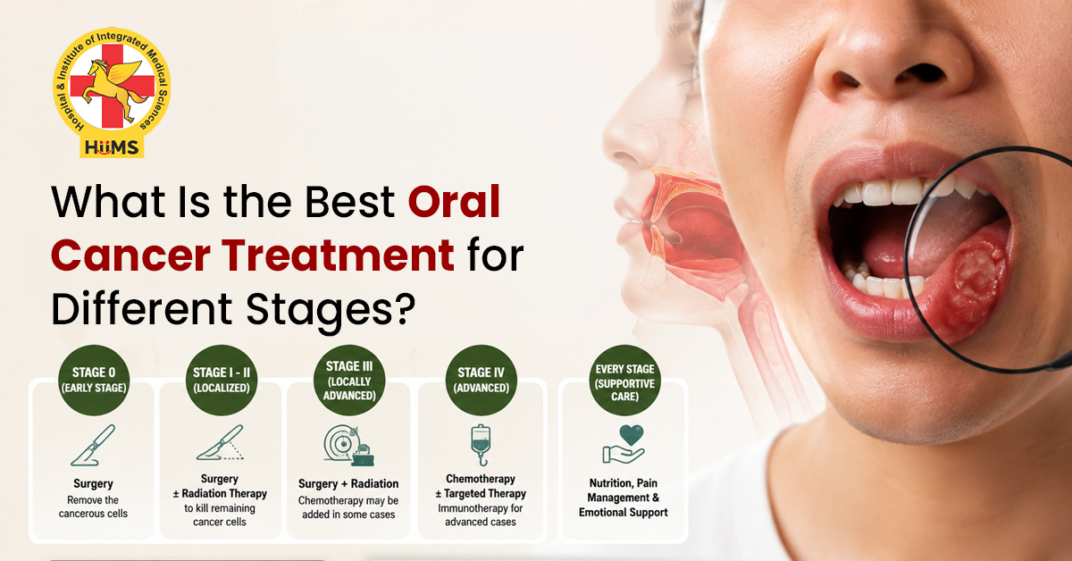 What-Is-the-Best-Oral-Cancer-Treatment-for-Different-Stages