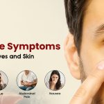 Jaundice Symptoms: Why Do the Eyes and Skin Turn Yellow?