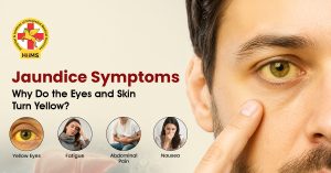 Jaundice-Symptoms
