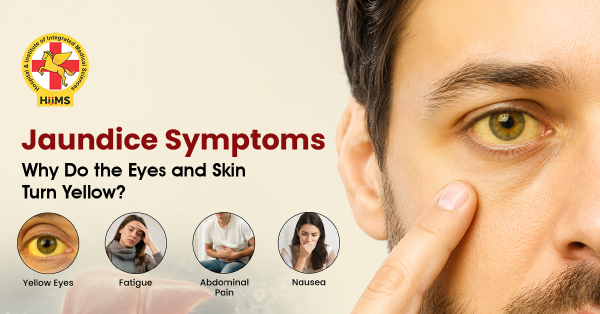 Jaundice-Symptoms