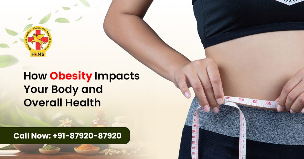 causes of obesity