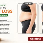 Best Ayurvedic Treatment for Weight Loss for Daily Routine