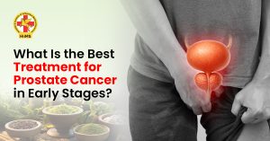 What Is the Best Treatment for Prostate Cancer in Early Stages