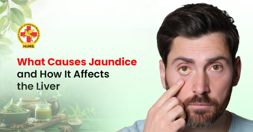 What Causes Jaundice and How It Affects the Liver