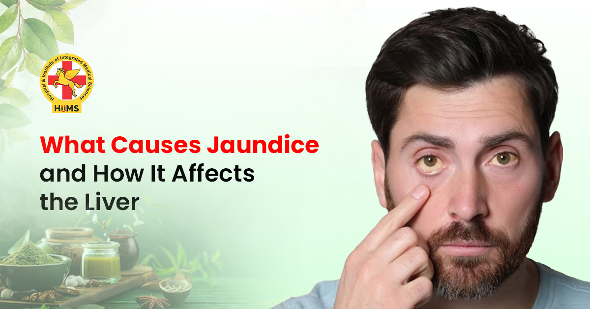 What Causes Jaundice and How It Affects the Liver