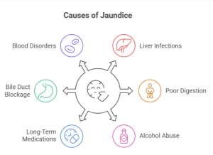 jaundice causes