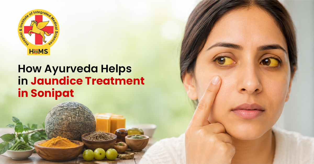 Jaundice Treatment in Sonipat