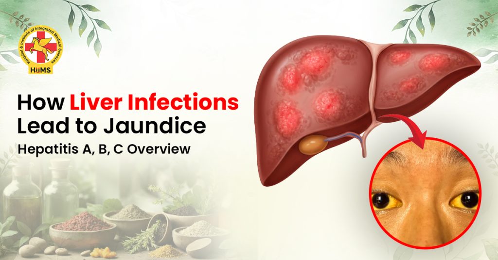 Jaundice Treatment in Surat