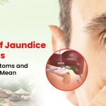Types of Jaundice in Adults