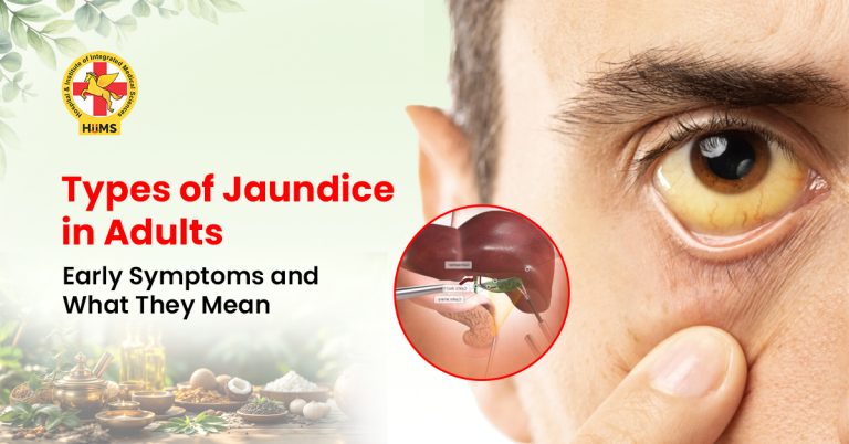 Types of Jaundice in Adults