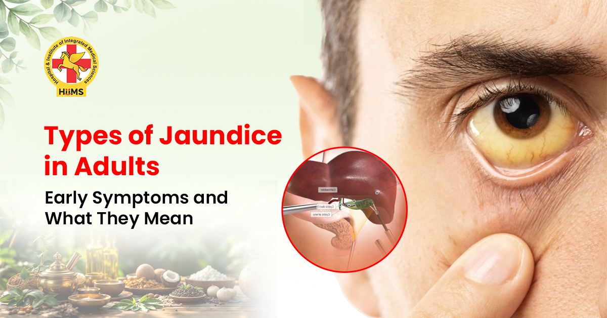 Types of Jaundice in Adults