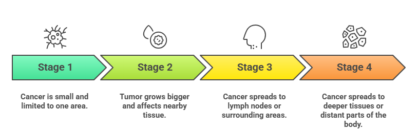 Throat Cancer Treatment Stages