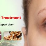 Jaundice Treatment Food List: Best Diet to Support Liver Healing