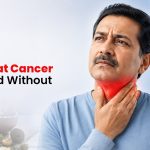 Can Throat Cancer Be Treated Without Surgery?