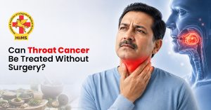 Can Throat Cancer Be Treated Without Surgery