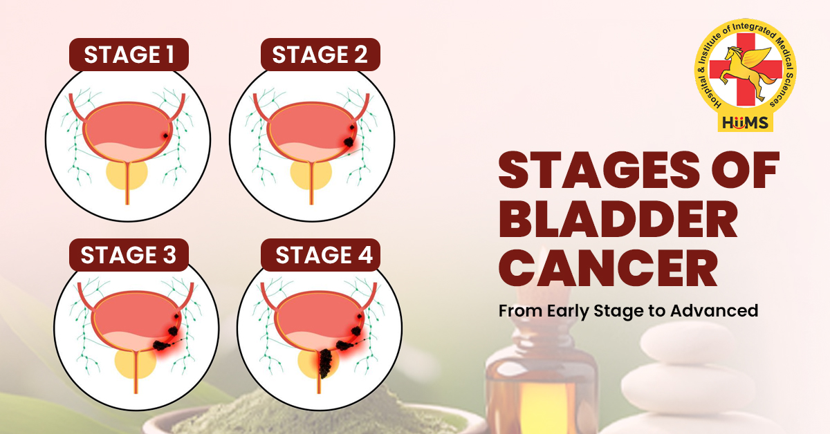 Bladder Cancer