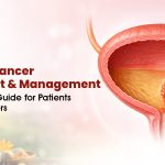 Bladder Cancer Treatment & Management: A Complete Guide for Patients and Caregivers