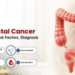 Colorectal Cancer: Early Signs, Risk Factors, Diagnosis & Treatment