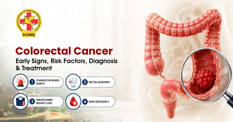 Colorectal Cancer Early Signs