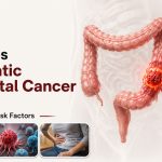 How Does Metastatic Colorectal Cancer Spread? Signs and Risk Factors