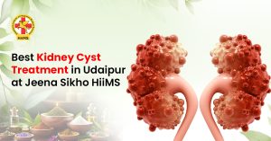 Kidney-Cyst-Treatment