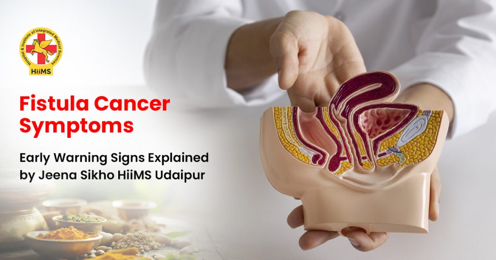 Fistula-Cancer-Symptoms