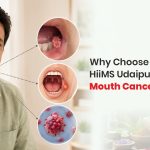 Mouth-Cancer-Treatment