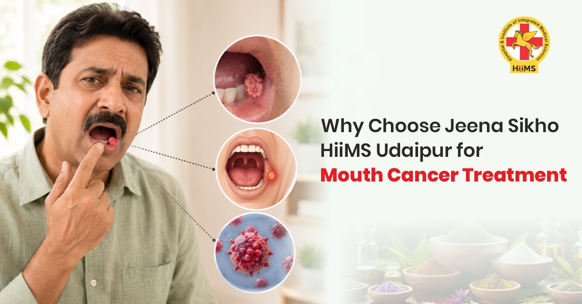 Mouth-Cancer-Treatment