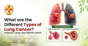Types-of-Lung-Cancer