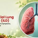 Interstitial Lung Disease (ILD): Complete Guide to Symptoms, Types & Treatment