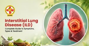 interstitial lung disease
