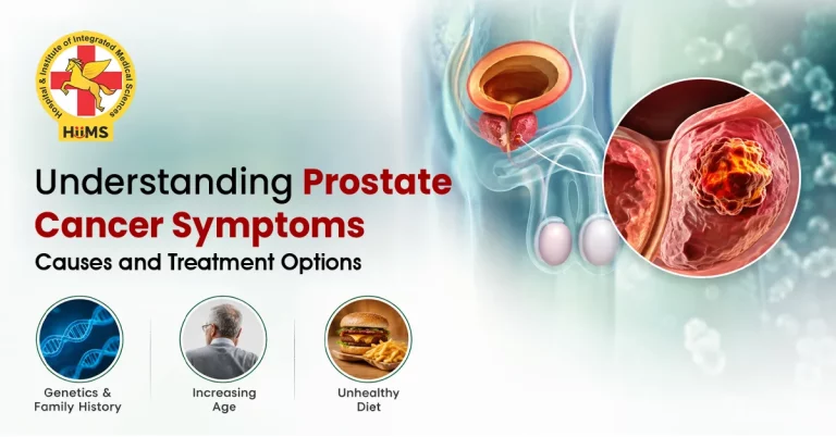 Prostate-Cancer-Symptoms