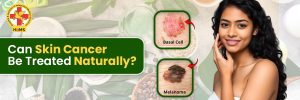 can skin cancer be treated naturally