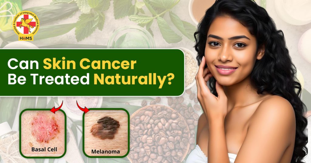 can skin cancer be treated naturally