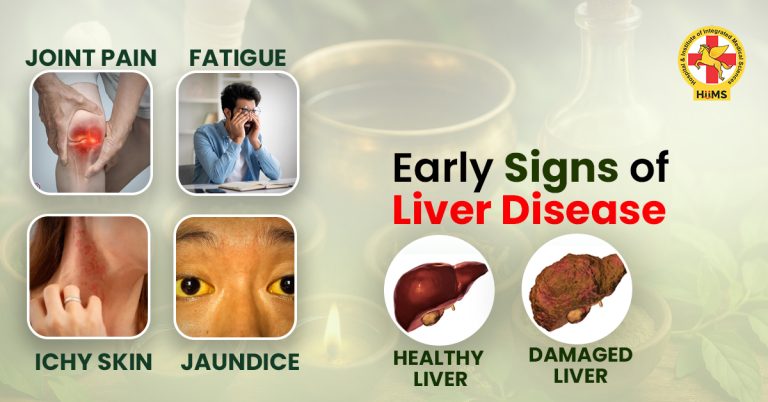 signs of liver disease
