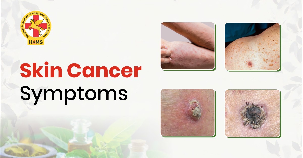 skin cancer symptoms