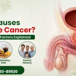 What Causes Prostate Cancer? Common Risk Factors Explained