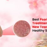Best Psoriasis Treatment in Kolkata New Town for Healthy Skin