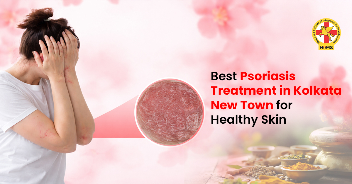 Psoriasis Treatment