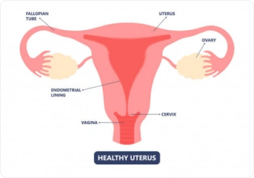Infertility