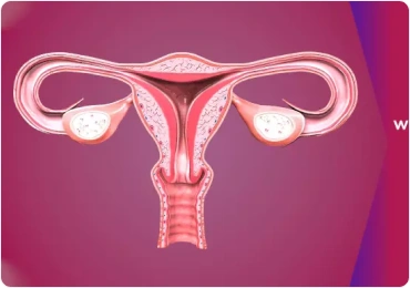Infertility